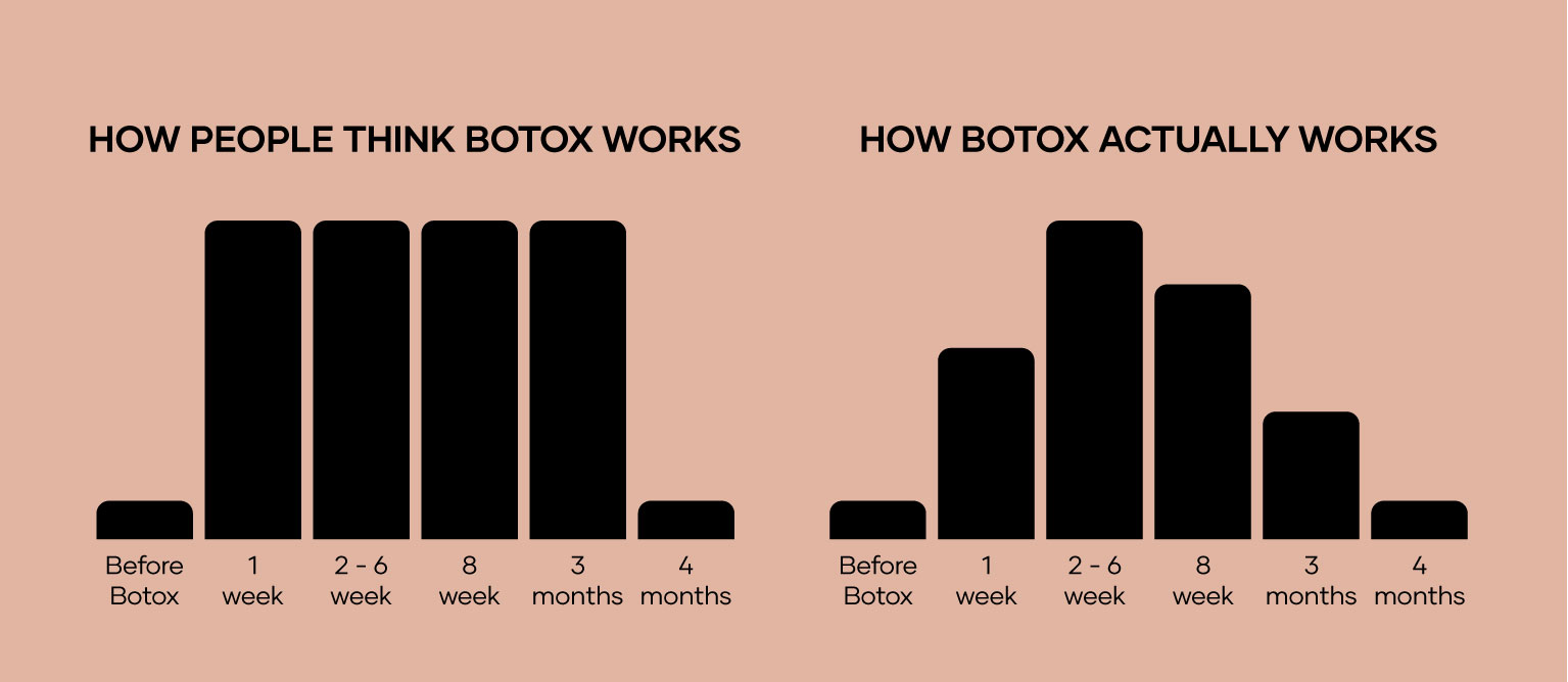 How Botox work Before AFter botox - relaxation muscle